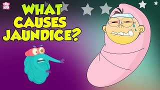 Jaundice  Causes of Jaundice  The Dr Binocs Show  Peekaboo Kidz [upl. by Seale]