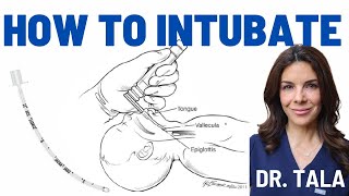 Neonatal intubation made SUPER EASY Stepbystep instructions [upl. by Zuliram399]