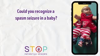 Could you recognize a spasm seizure in a baby [upl. by Aerdnak]