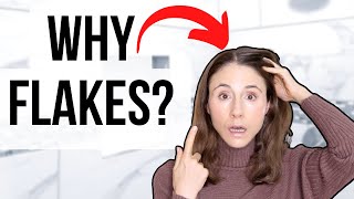 Why Your Scalp Is Flaky The Difference Between Dryness And Dandruff Explained [upl. by Oinotnanauj12]