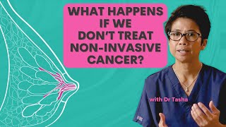 What is DCIS and What Happens if We Dont Treat It  with Dr Tasha [upl. by Guntar881]