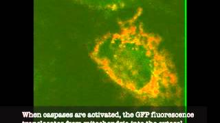 Cells undergoing cell death by apoptosis [upl. by Dhruv]