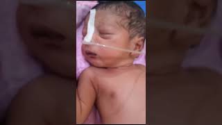 doctor newborn baby crying all video during suction treatment and heathly sound [upl. by Abrahan]