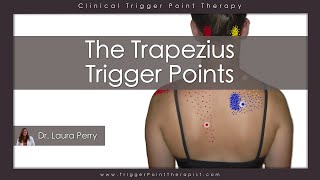 The Trapezius Trigger Points [upl. by Ecille]