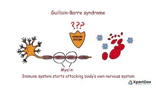 Guillain Barre Syndrome  Where bodys immune system attacks its nervous system [upl. by Leifeste607]