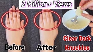 Do This Every Night For 7 Days To Lighten Dark Knuckles And Brighten Hands amp Feet  Faiqa Studio [upl. by Aileda]