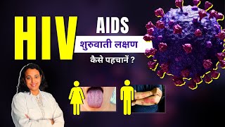 HIV Symptoms in Men amp Women  AIDS Aur HIV ke Lakshan Kya Hote Hai [upl. by Nerty]