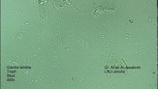 Giardia lamblia intestinalis trophozoite [upl. by Nehttam]