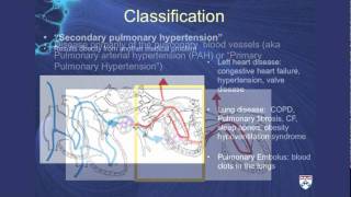 Pulmonary Hypertension A challenging cause of shortness of breath [upl. by Eanar]