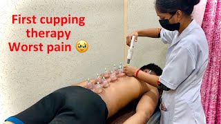 Complete cupping therapy and US  Kashish Raj fitness fitness therapy treatment pain muscle [upl. by Donohue]