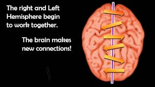 Introduction Neuroanatomy Video Lab  Brain Dissections [upl. by Rehctaht176]