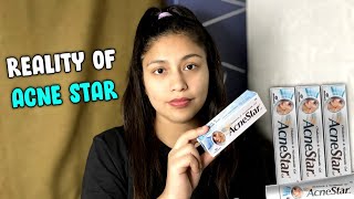 Acnestar Gel review  How to Get rid of Acne  Noni Roga [upl. by Eiramnwad230]