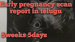 Early pregnancy scan report in Telugu early pregnancy scan 5 weeks 5days [upl. by Nnaynaffit]