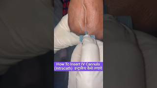 How To Insert IV Cannula  Intravenous Cannula Method  IV Cannulaकैसे लगाएं  Intracath shorts [upl. by Harriot113]