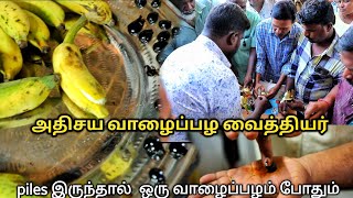 🔴piles தீர்வுக்கு வாழைப்பழத்தில் மருந்து  அதிசய வைத்திய முறை  yummyvlogs [upl. by Belloir]