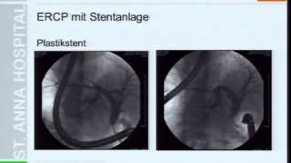 Palliative endoskopische Therapie des Pankreaskarzinoms Teil I [upl. by Tegdig]