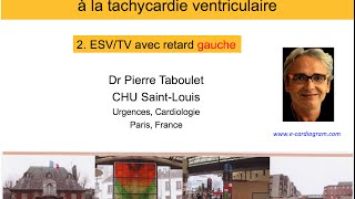 10b De lESV à la tachycardie ventriculaire Retard gauche P Taboulet [upl. by Hannibal]