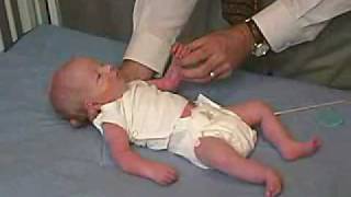 neurology exam newbornabnormal Primitive Reflexes  Moro [upl. by Rafaelia]