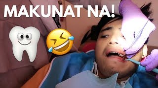 BINUNUTAN AKO Wisdom Tooth Removal ROUND 1 [upl. by Evaleen]