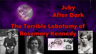 The Terrible Lobotomy of Rosemary Kennedy [upl. by Floria]