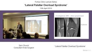 Lateral Patellar Overload Syndrome [upl. by Elyagiba]