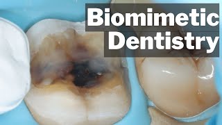 Biomimetic Dentistry  What Actually Is It  PDP135 [upl. by Urissa180]