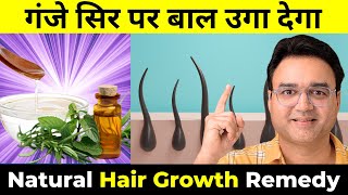 सिर्फ 4 बूंदे नारियल के तेल में मिला लो  गंजे सिर पर बाल उगा देगा  2X Hair Growth Oil [upl. by Aicela]