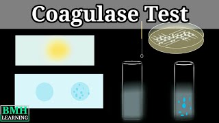 Coagulase Test  Coagulase Test For Staphylococcus Aureus [upl. by Bridgette]