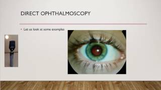 How to do fundoscopy A direct ophthalmoscopy OSCE [upl. by Petunia]