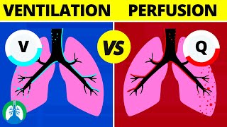 VentilationPerfusion VQ Ratio  Quick Medical Overview [upl. by Savvas]