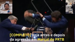 🔥 Completo Veja antes e depois da agressão em Pablo Marçal  Hospitalizado 🔥 [upl. by Nnorahs]