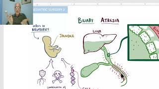 Paediatric surgery in Arabic 13  Biliary Atresia  by Dr Wahdan [upl. by Ardnohsed]