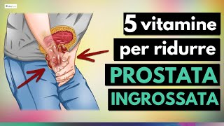 5 migliori VITAMINE per ridurre la PROSTATA ingrossata [upl. by Ahseket]