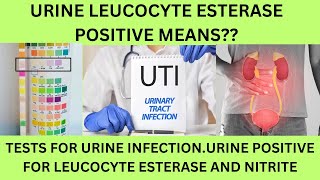 URINE EXAMINATION LEUCOCYTE ESTERASE POSITIVE UTI URINARY NITRITE AND LEUCOCYTE ESTERASE POSITIVE [upl. by Nosredneh]