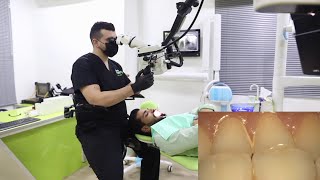 Dental Microscope  How To Increase Efficiency And Patient Satisfaction [upl. by Hadwyn]