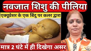 Neonatal JaundiceJaundice in new bornनवजात में पीलिया का होनाफिजिओलाजिकल पीलियाbachcho ki pilia [upl. by Nnyleahs]