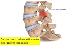 Causes des troubles articulaires des facettes lombaires [upl. by Ancalin]