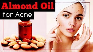 This is How to Use Almond Oil for Acne and Scars [upl. by Dlonra]