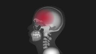 Protecting the brain after traumatic brain injury the role of multimodality neuromonitoring [upl. by Ehcrop]