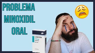 Mi PROBLEMA con MINOXIDIL ORAL EFECTO SECUNDARIO [upl. by Adelaja]