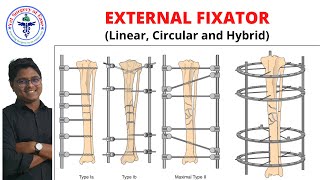 External Fixator  Lecture 07  Orthopedics [upl. by Mima]