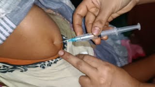 IM Intramuscular Arm injection Push Hydrocortisone  Cotson  injection 24 Ep 99 Anik Health Tips [upl. by Yreved]