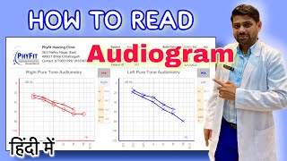 How to read Audiogram  Explained in Hindi  सुनाई की जाँच Audiometry test रिपोर्ट को कैसे पढ़ें [upl. by Lois]