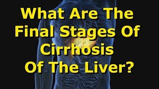 What Are The Final Stages Of Cirrhosis Of The Liver [upl. by Paige390]