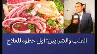 الدكتور محمد فائد  أمراض القلب والشرايين  أول خطوة في العلاج [upl. by Land]