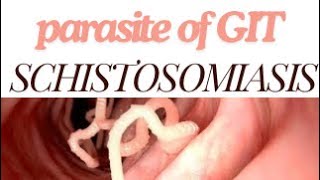 Parastology schistosomiasis 🪱 part 2 [upl. by Einttirb]