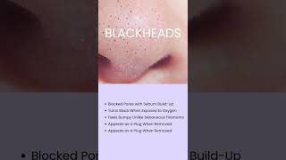 Tired of blackheads Youre not alone Heres the difference between blackheads ampsebaceous filaments [upl. by Dadirac]