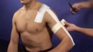 AC acromioclavicular Joint Taping Technique [upl. by Teragramyram503]