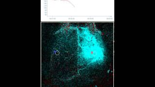 Needle induced Cortical Spreading Depression  Difference Image mode [upl. by Laitselec]