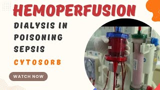 What is Hemoperfusion  Dialysis in Poisoning  Dialysis in sepsis  cytosorb [upl. by Infeld]